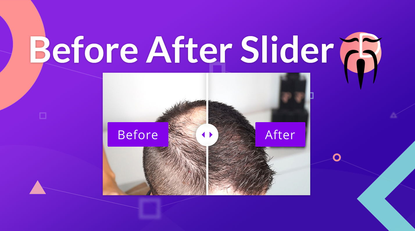 Divi Sensei Before After Slider v2.2.2（已汉化） – Wp Divi前后对比图插件